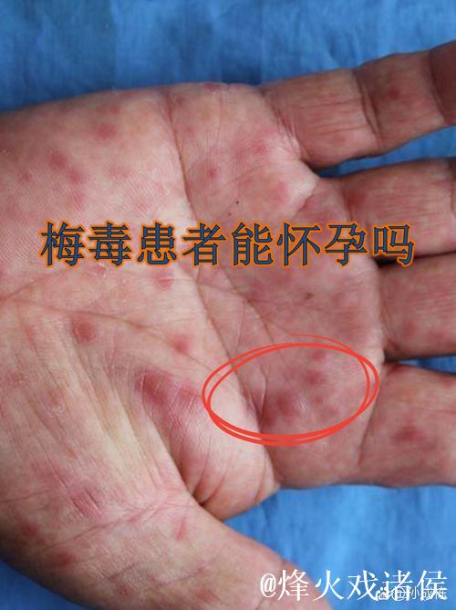 德甲：法兰克福全员新冠检测呈阴性 四患者已康复